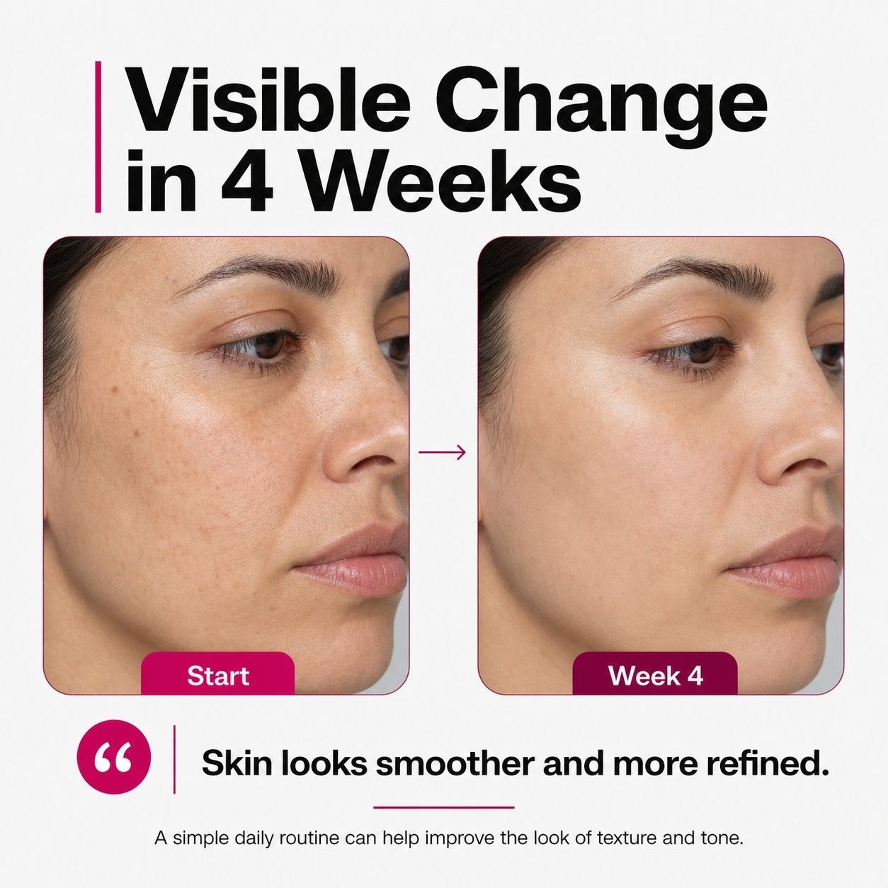 Newumask - Radiance Pro Therapy Mask 50% OFF