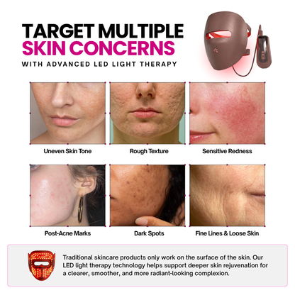Newumask - Radiance Pro Therapy Mask 50% OFF